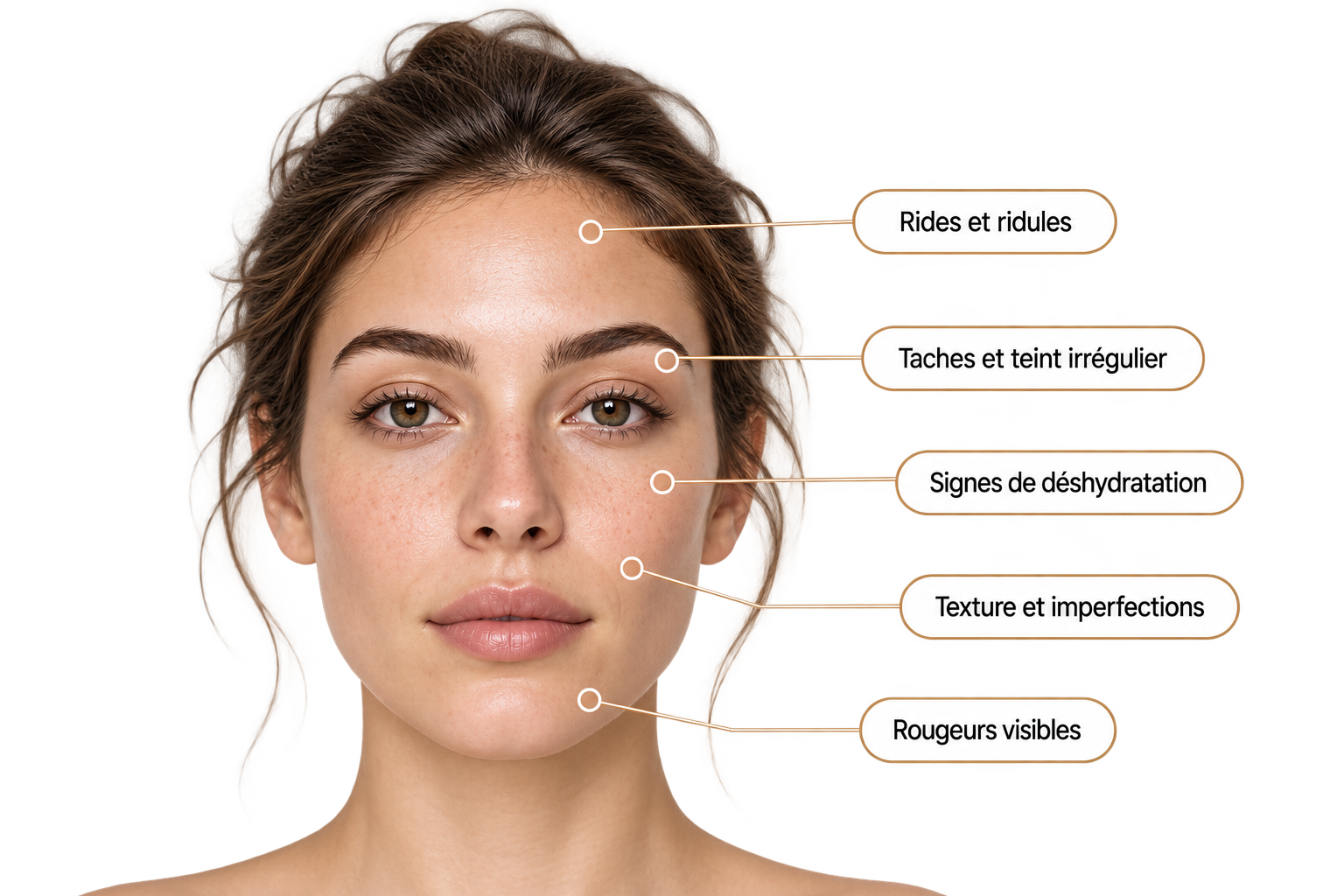 Analyse Soleen avec les zones et besoins observés sur le visage